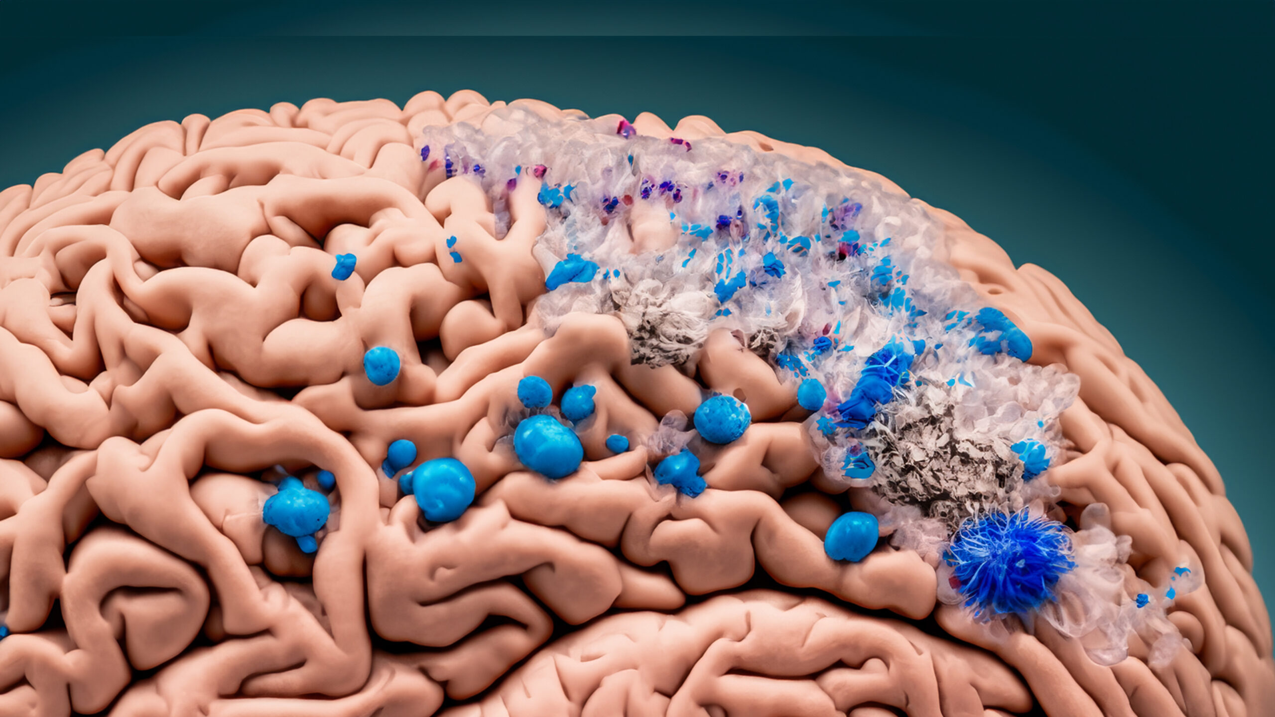 Microplastic Brain 1 scaled